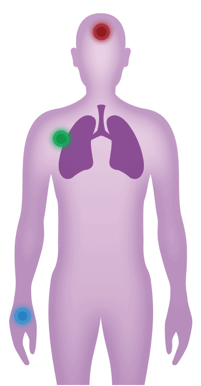 symptoms and impact on chest
