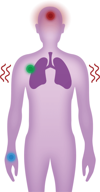 Síntomas y el impacto potencial de la neumonía neumocócica en tu cabeza